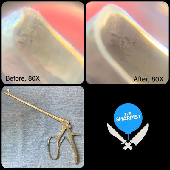 Surgical Instrument Before And After Photos