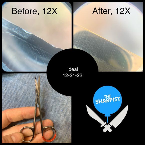 Surgical Instrument Before And After Photos