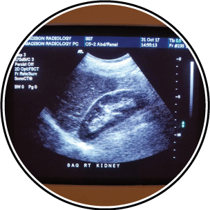 Diagnostic Ultrasound Imaging in Madison, CT & Guilford, CT