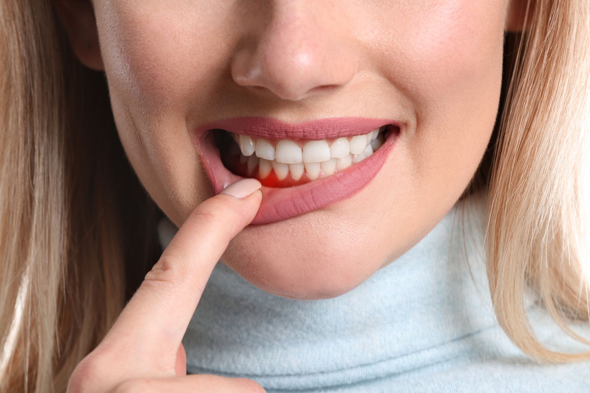 Woman pointing at inflamed, red gum next to her white teeth.