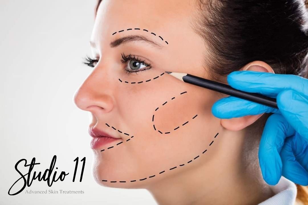 non-surgical facelifts