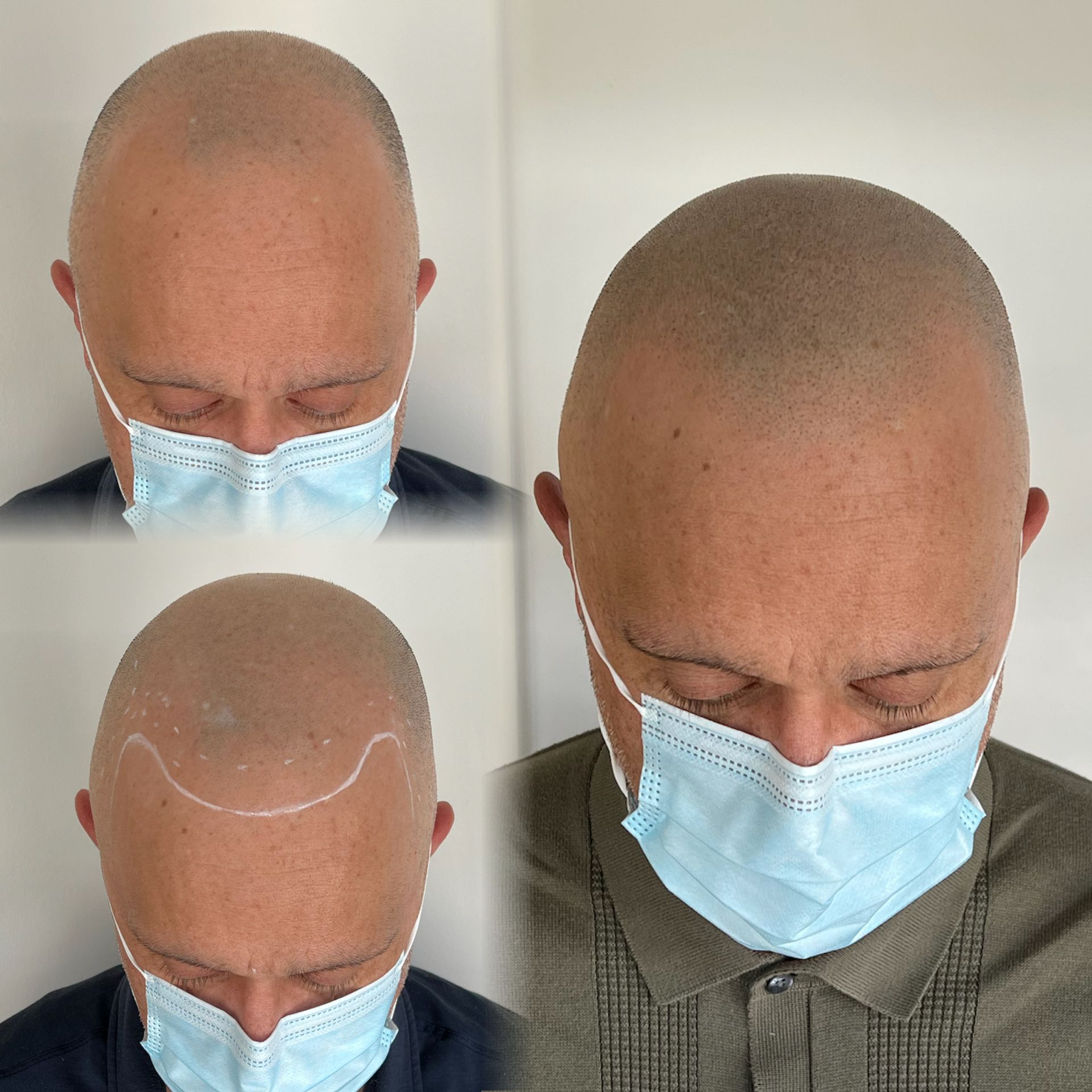 A man with a shaved head wearing a mask
