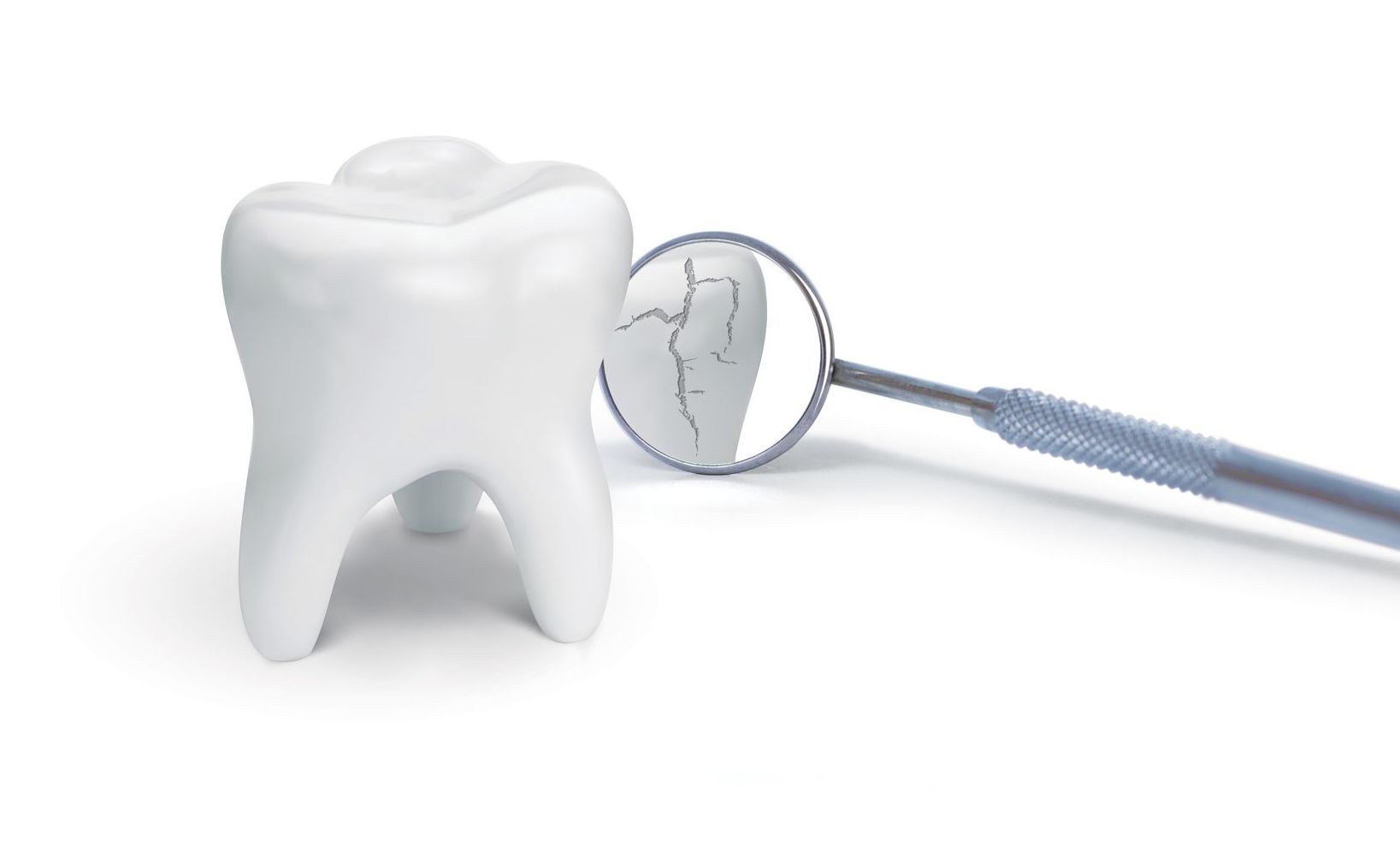 Un dente viene esaminato tramite uno specchio dentale. - Arte Dentale Frosinone