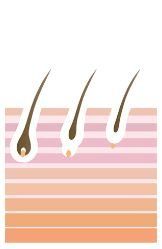 icona epilazione tramite luce pulsata