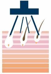 icona epilazione laser