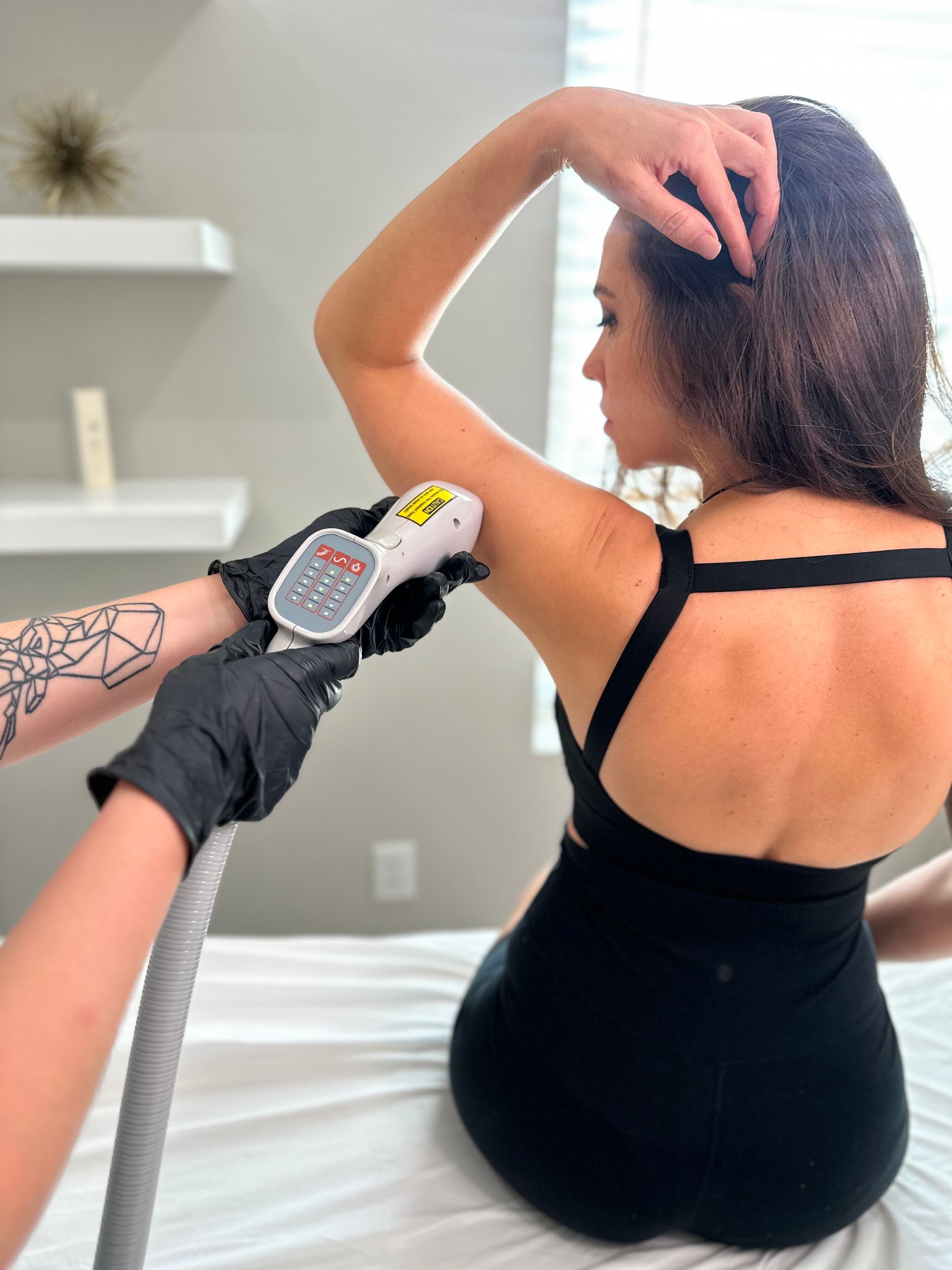 Woman receiving laser hair removal on her arm in a clinic setting. Black attire, gloved hand, device.
