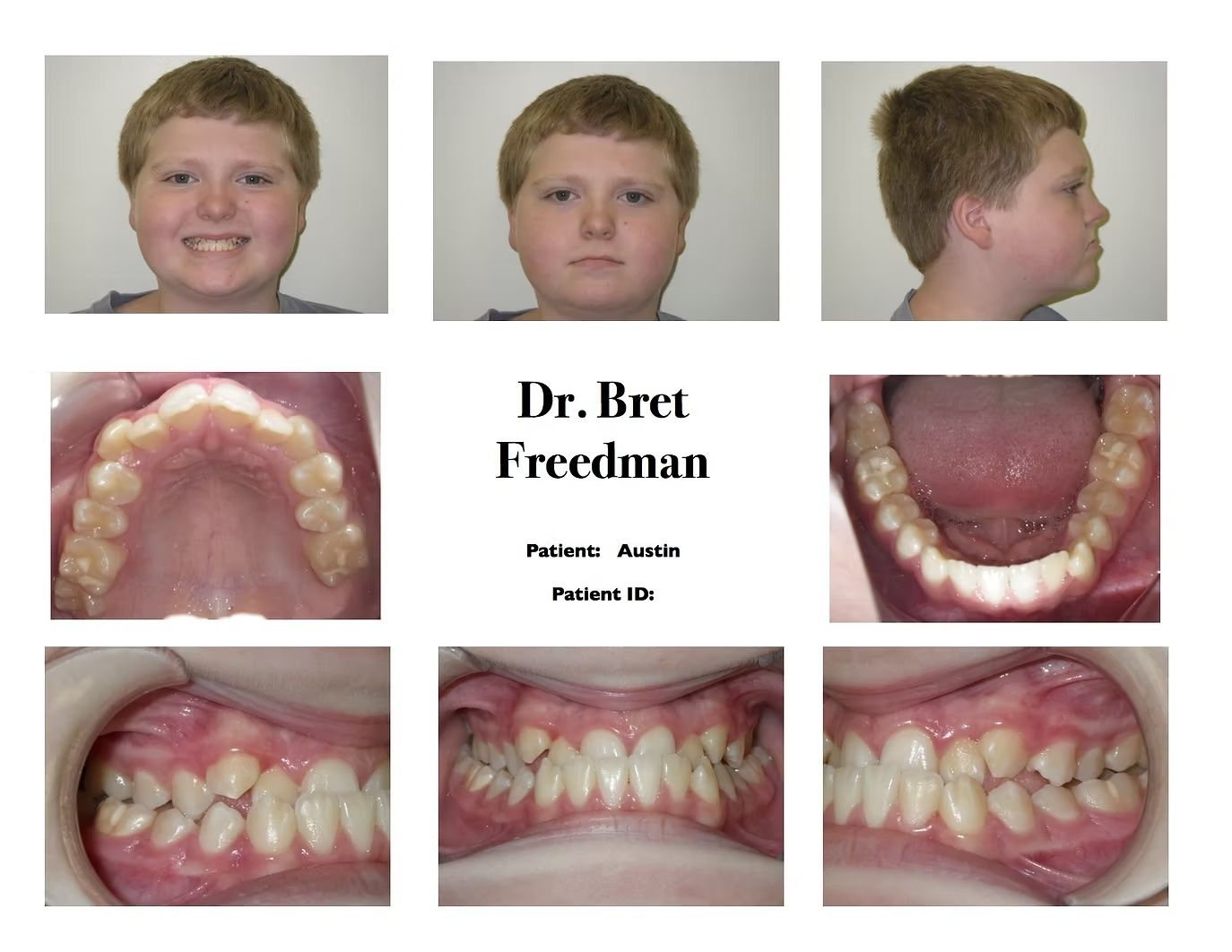 Orthodontic patient's dental exam. Facial and mouth views, with the name 