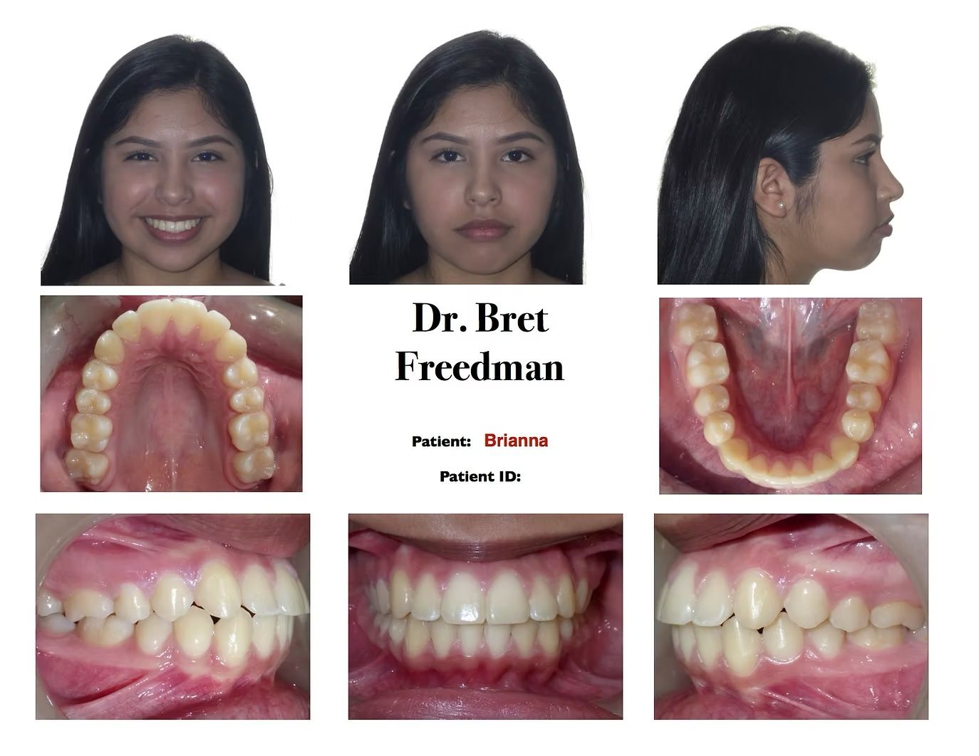 Orthodontic patient's facial and dental views, including smile, frontal, profile, and intraoral images.