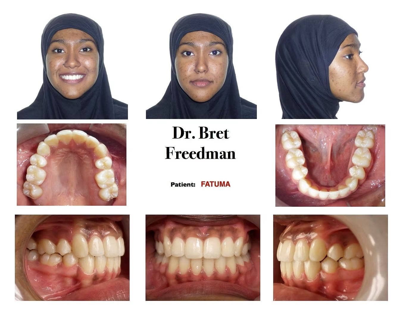 Orthodontic patient photos: face views, dental arch views, and occlusion views; Dr. Bret Freedman.