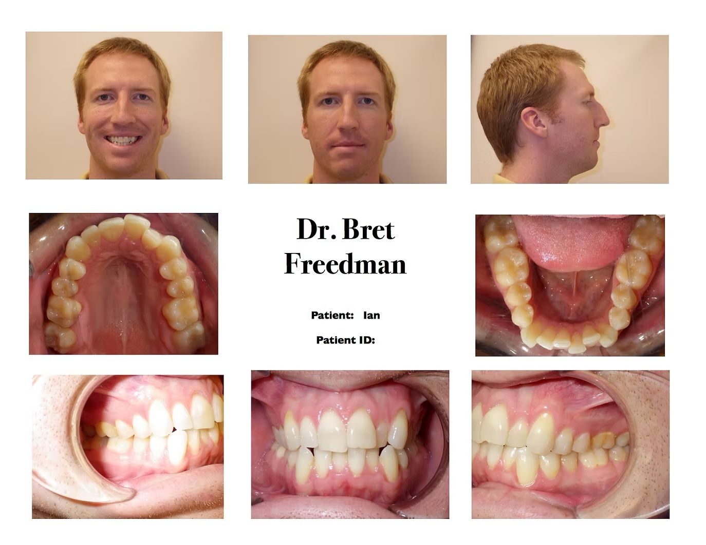 Inside view of a mouth showing lower and upper teeth, tongue, and gums.