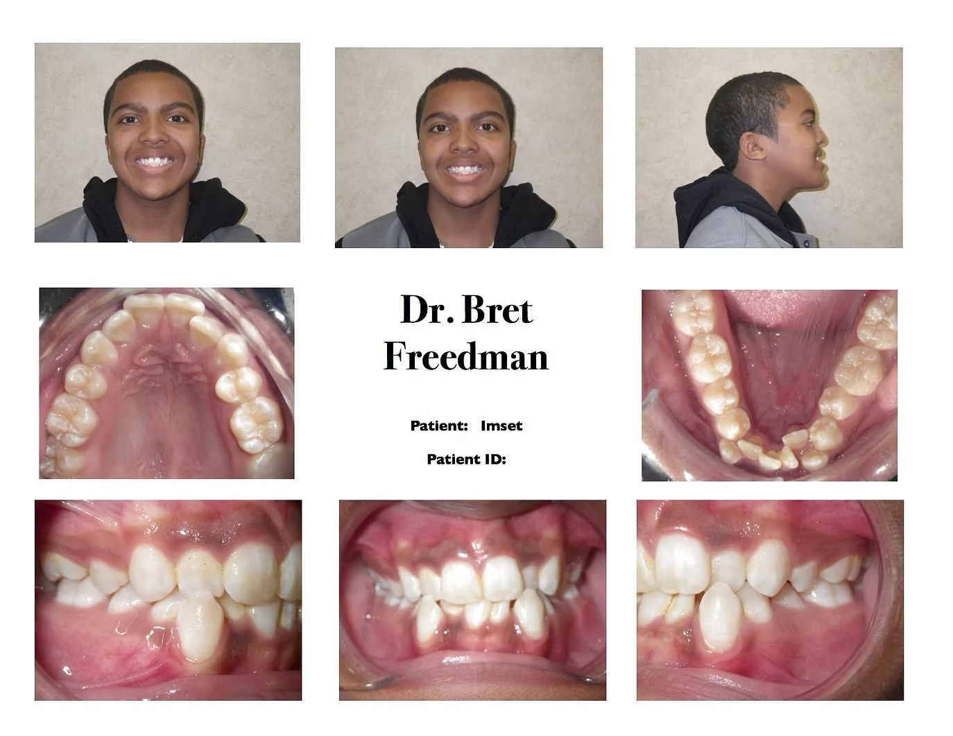 Dental exam photos of teeth and patient's face, displaying smiles and mouth open.