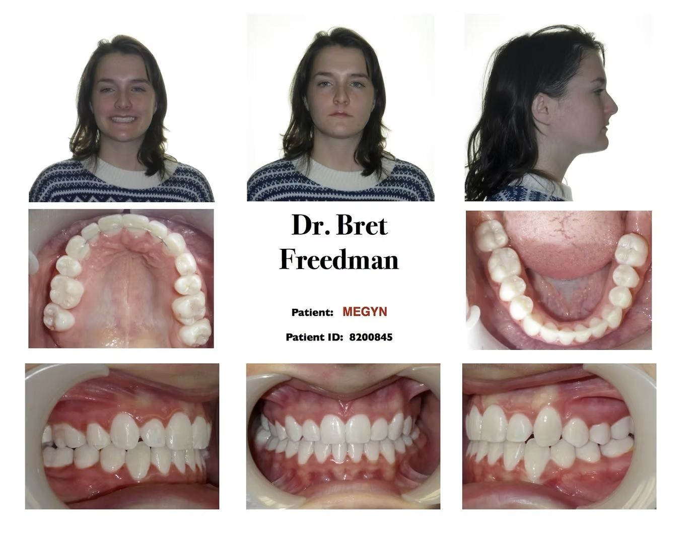 Orthodontic patient's facial and dental views, including smile, frontal, profile, and intraoral images.