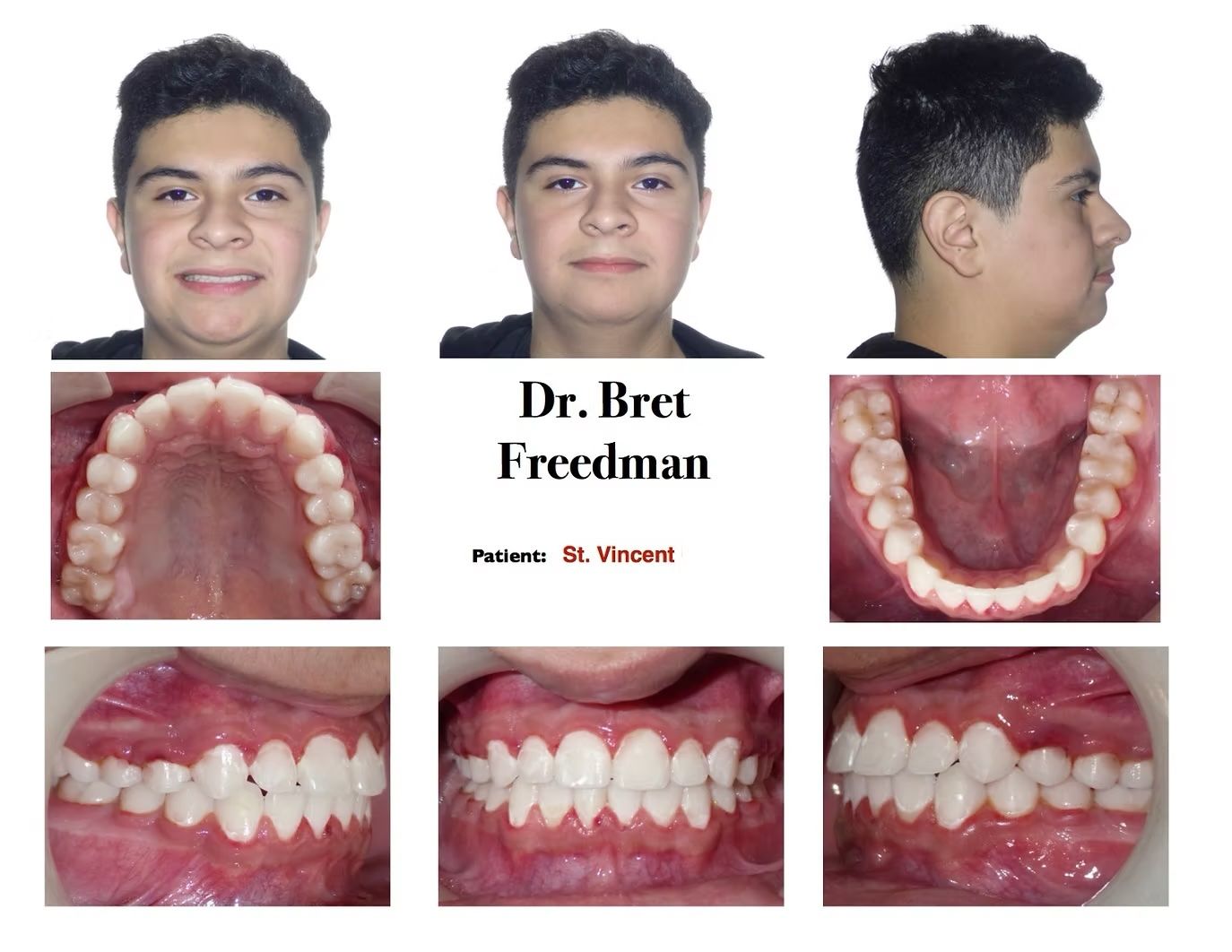 A person's face and teeth, with frontal, top, and side views, along with dental x-rays.