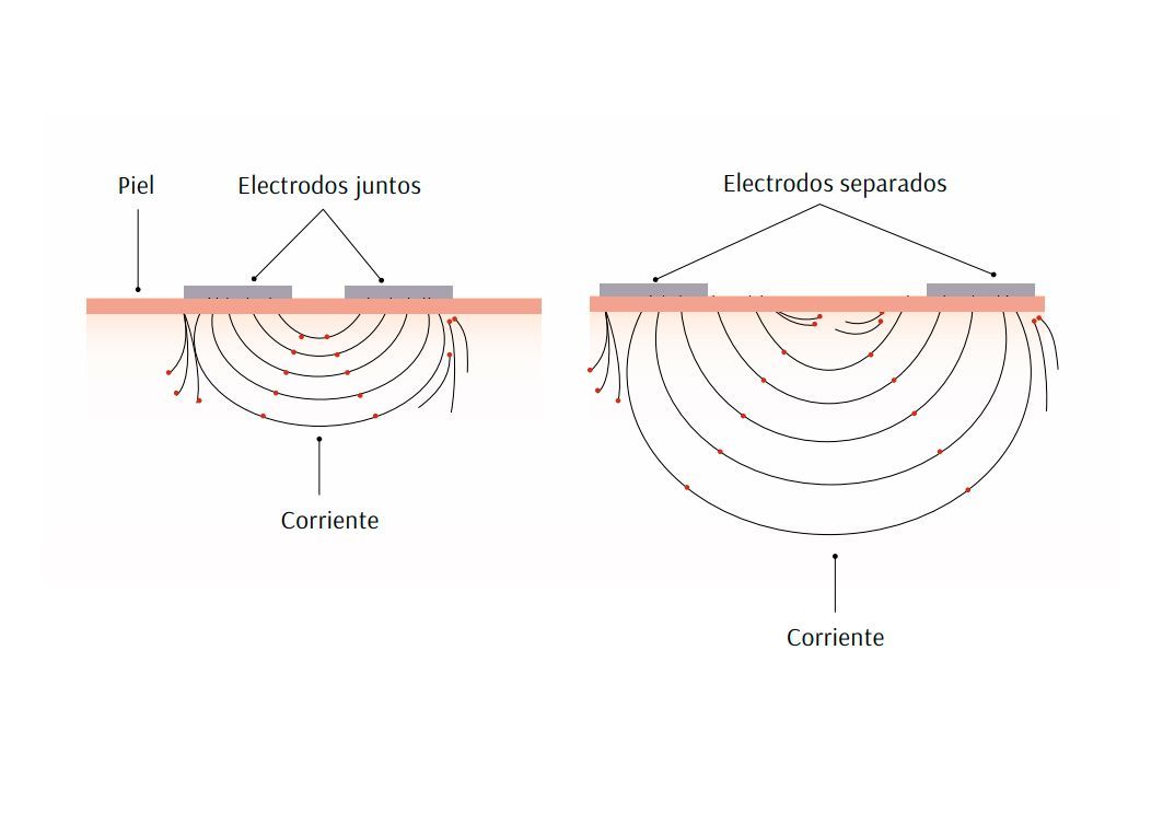 Fortalecimiento muscular