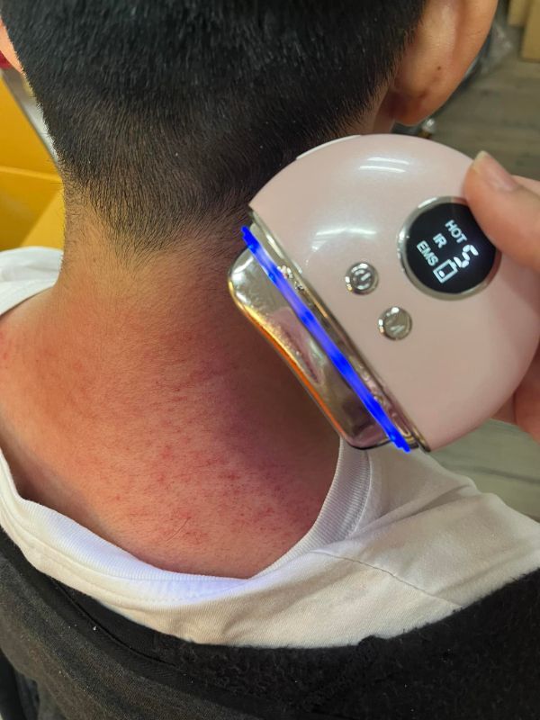 溫感震動刮痧儀