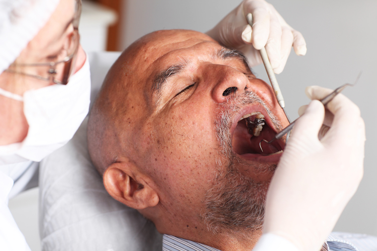 Root Canal Therapy