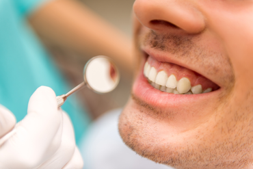 Dentist examining a man's teeth with a mirror; close-up of mouth, focus on white teeth.