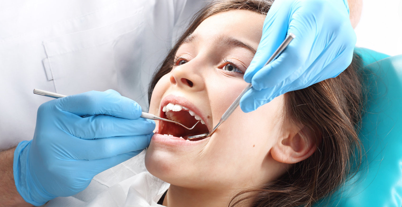 Are Dental Sealants Recommended for Kids?