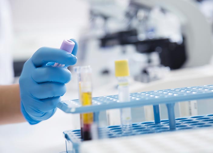 laboratorio análisis clínicos