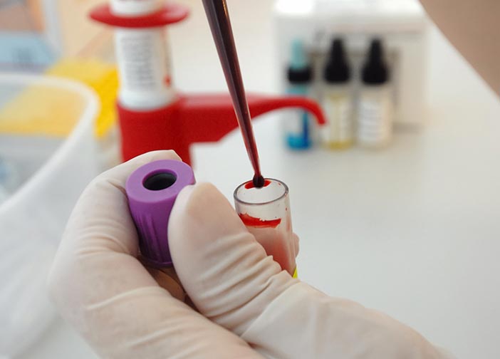 laboratorio análisis clínicos