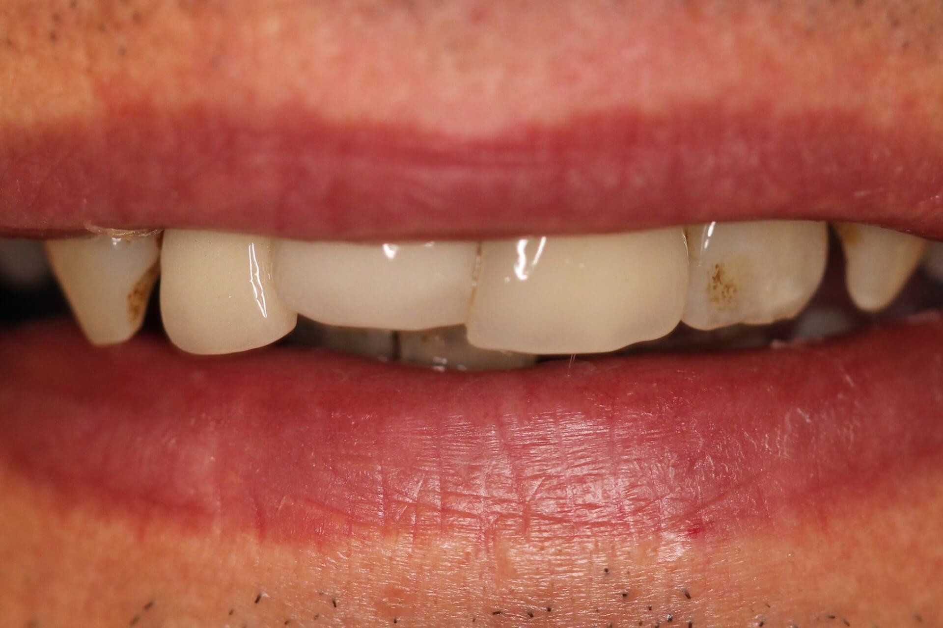 Our Before & After Smile Gallery Pall Mall Dental