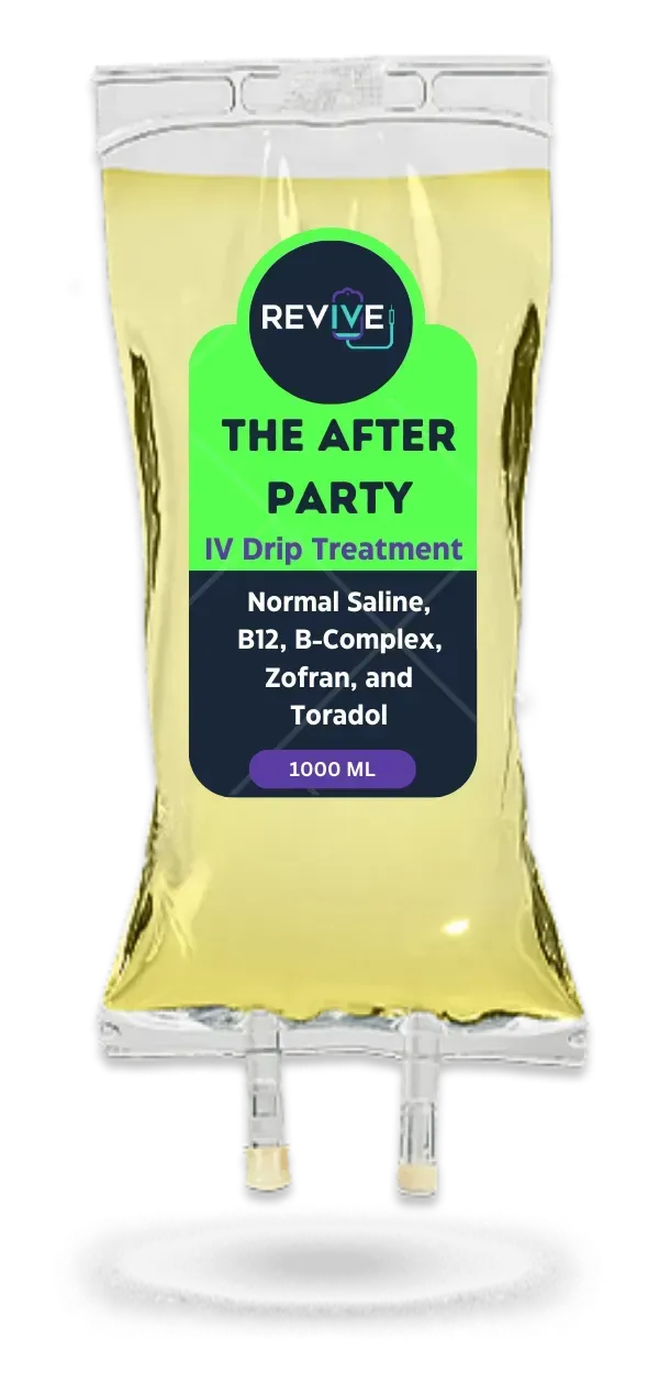 The After Party