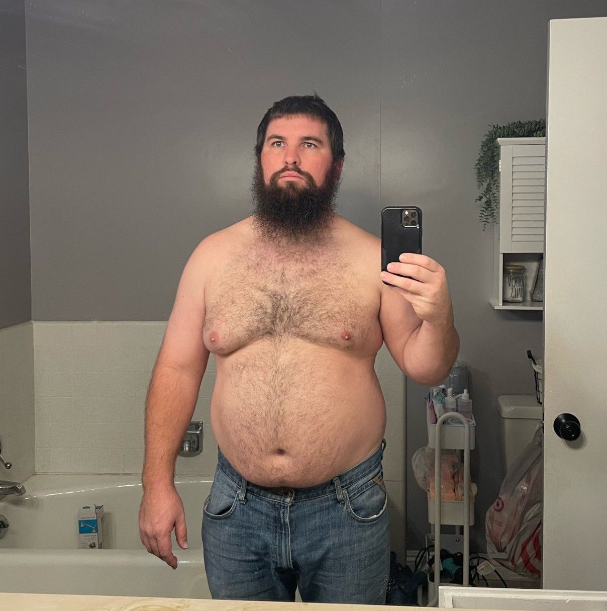 Before weight loss treatment using Semaglutide.