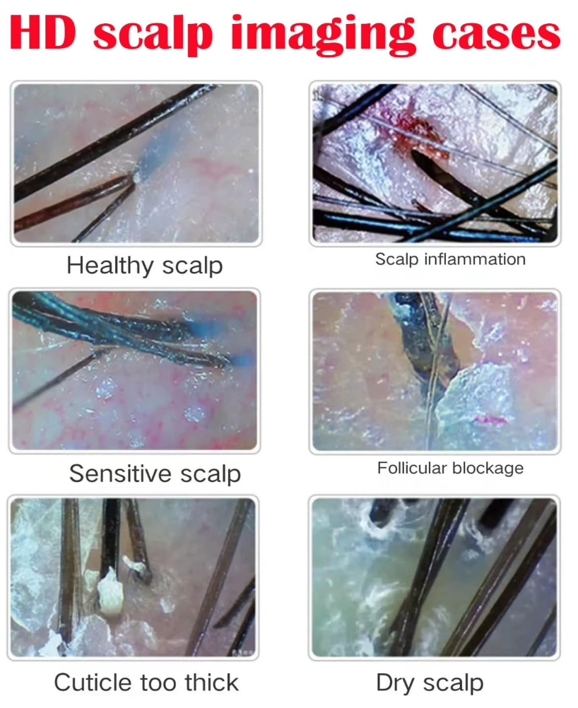 HD scalp imaging cases showing examples of healthy, inflamed, sensitive, blocked, thick cuticle, and dry scalps.