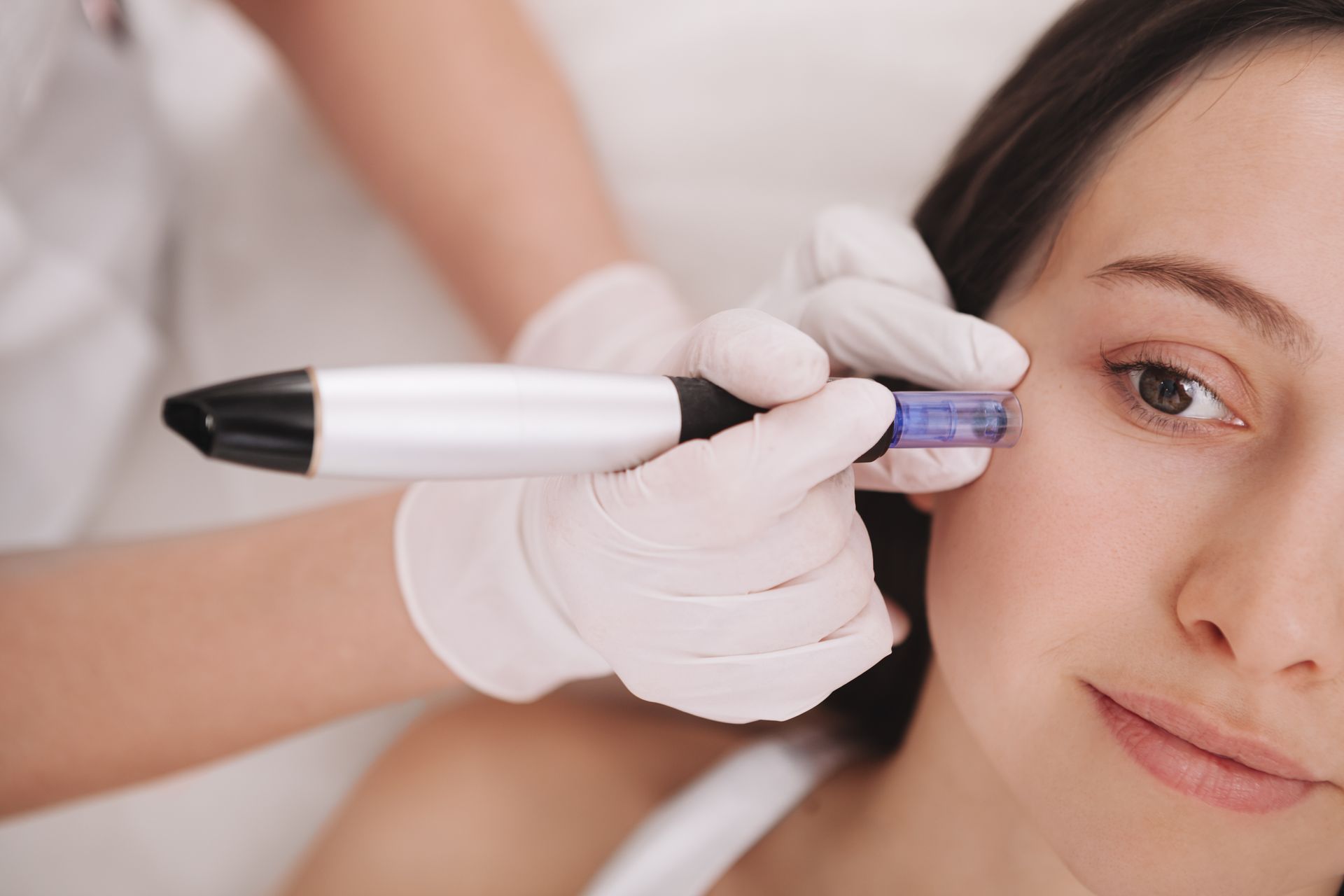Woman receiving microneedling treatment on her face, held by a gloved hand.