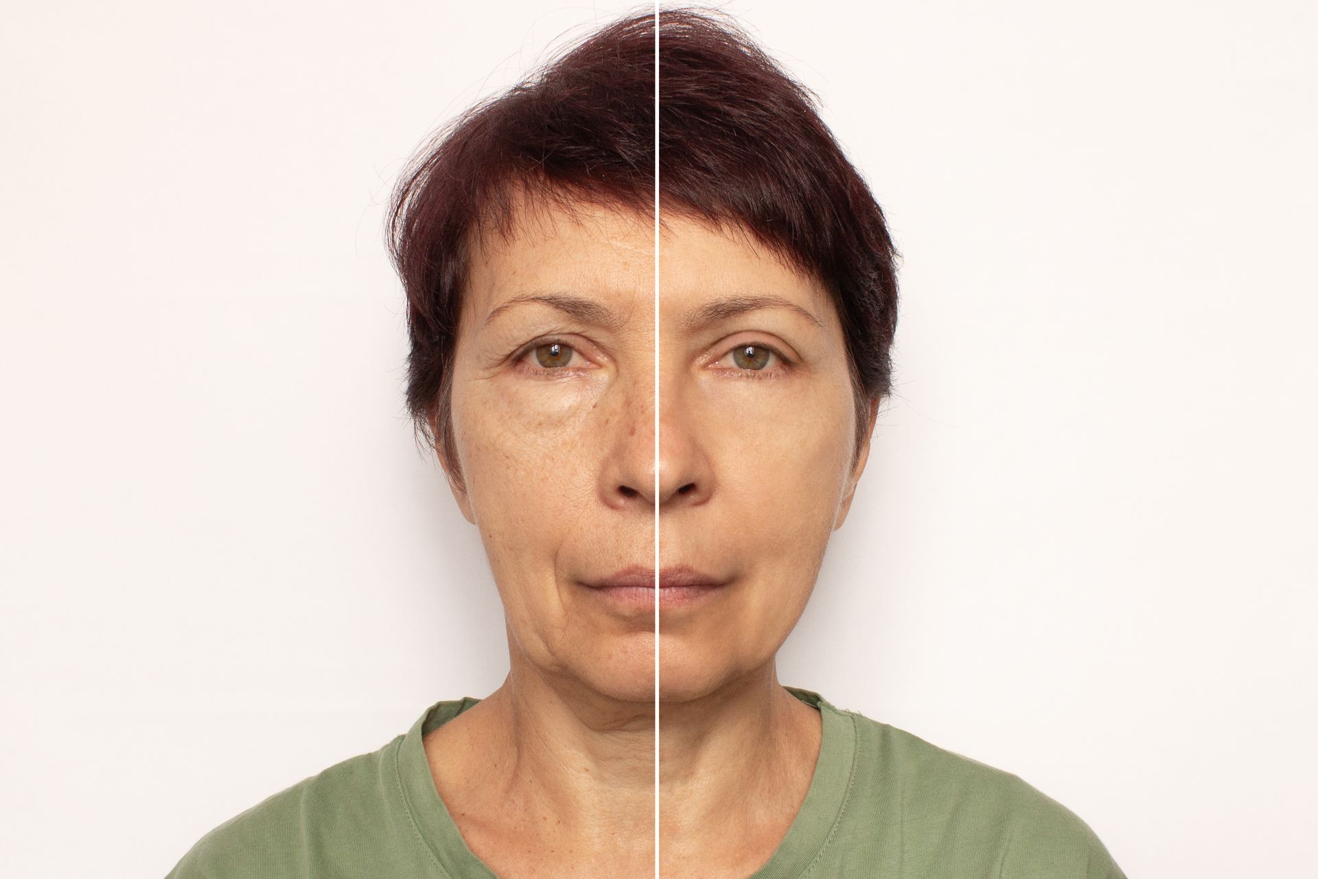 A before and after photo of a woman 's face.