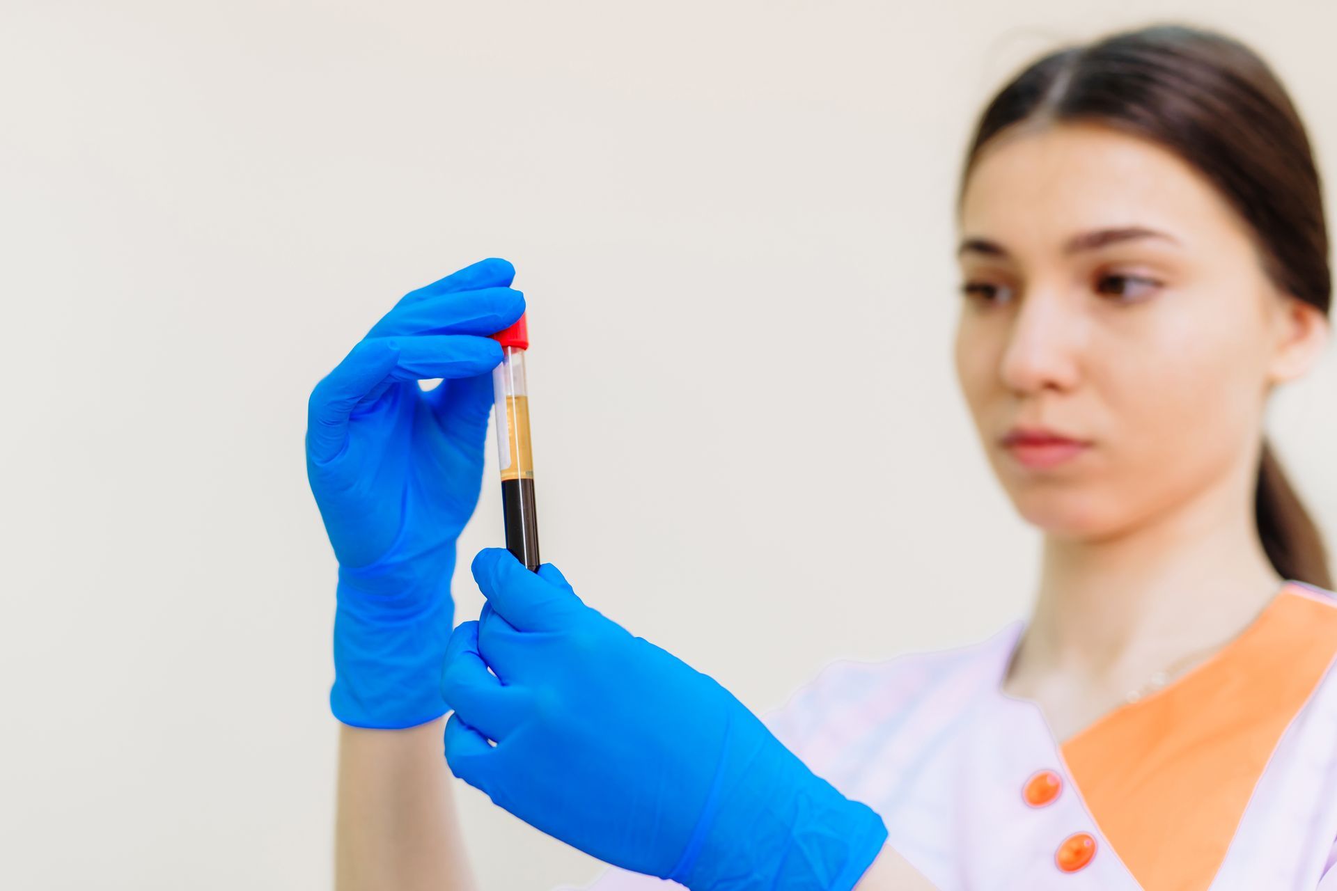 A nurse is preparing PRP 