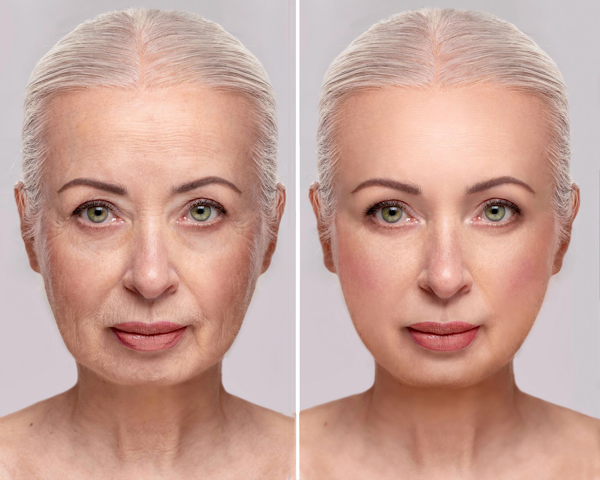 A before and after photo of an older woman's face.