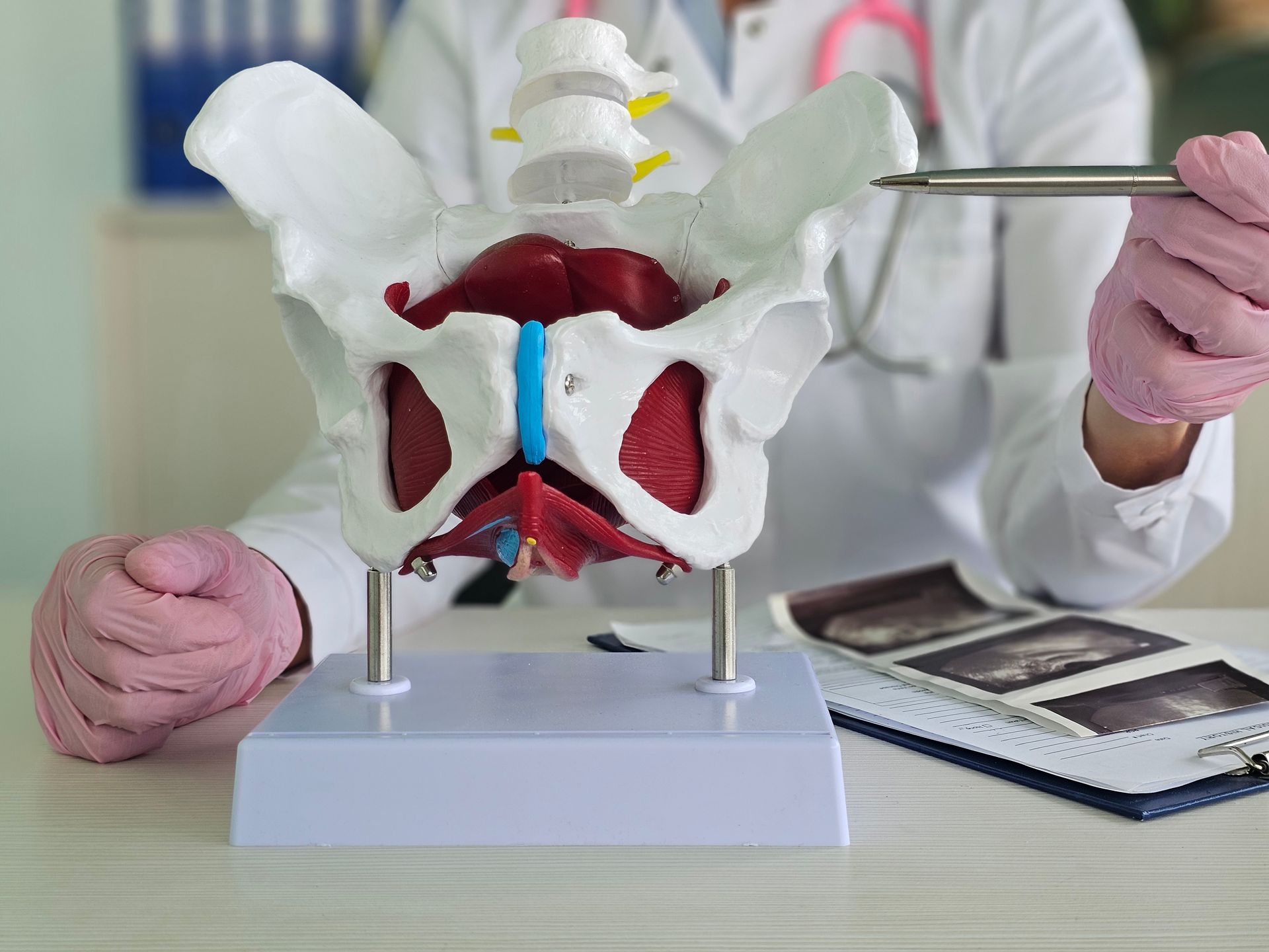 Doctor holds model of pelvic bone. Effective treatment of chronic pelvic pain concept.