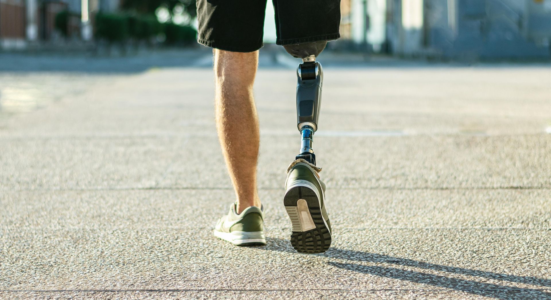 A man with a prosthetic leg is walking down the street.