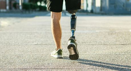 A man with a prosthetic leg is walking down the street.