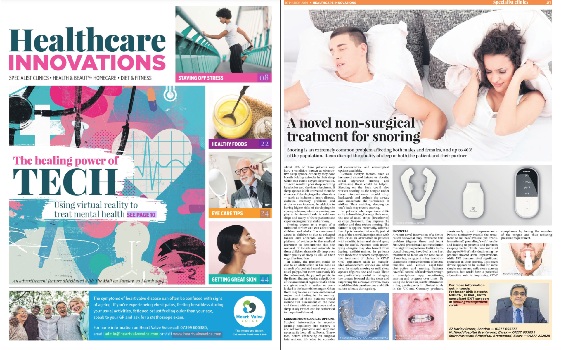 Snoring article on snoring treatment featured in Healthcare Innovations