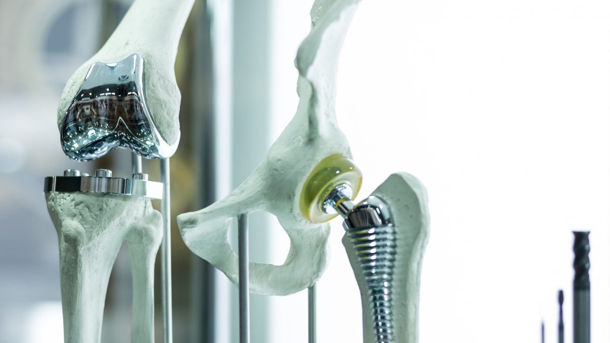 Hip Replacement Surgery Know about the Purpose, Procedure, and Recovery