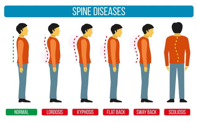 Cervical Spine Infection Care