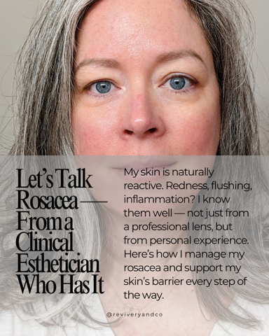 rosacea treatment