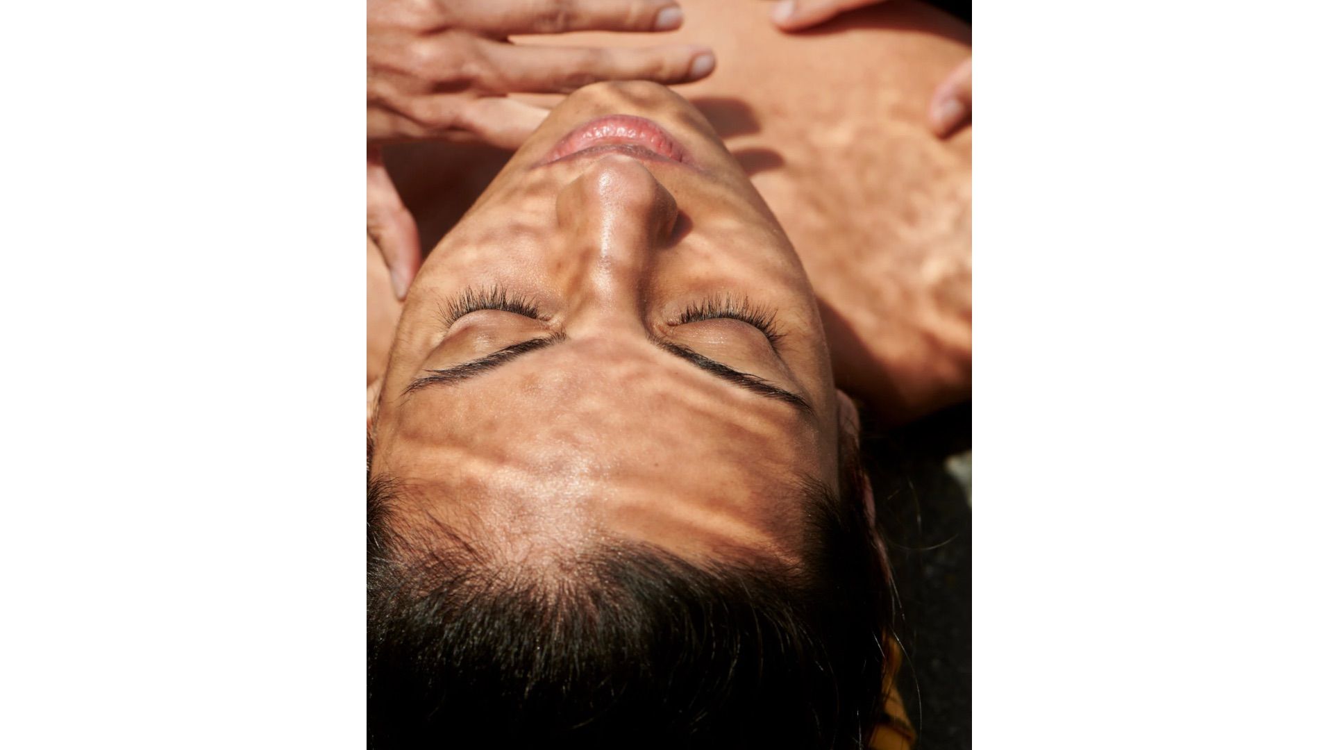 getting a microneedling in cochrane