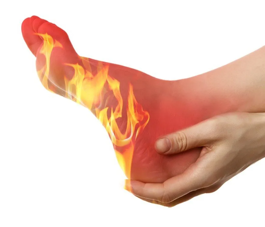 Burning Foot Pain