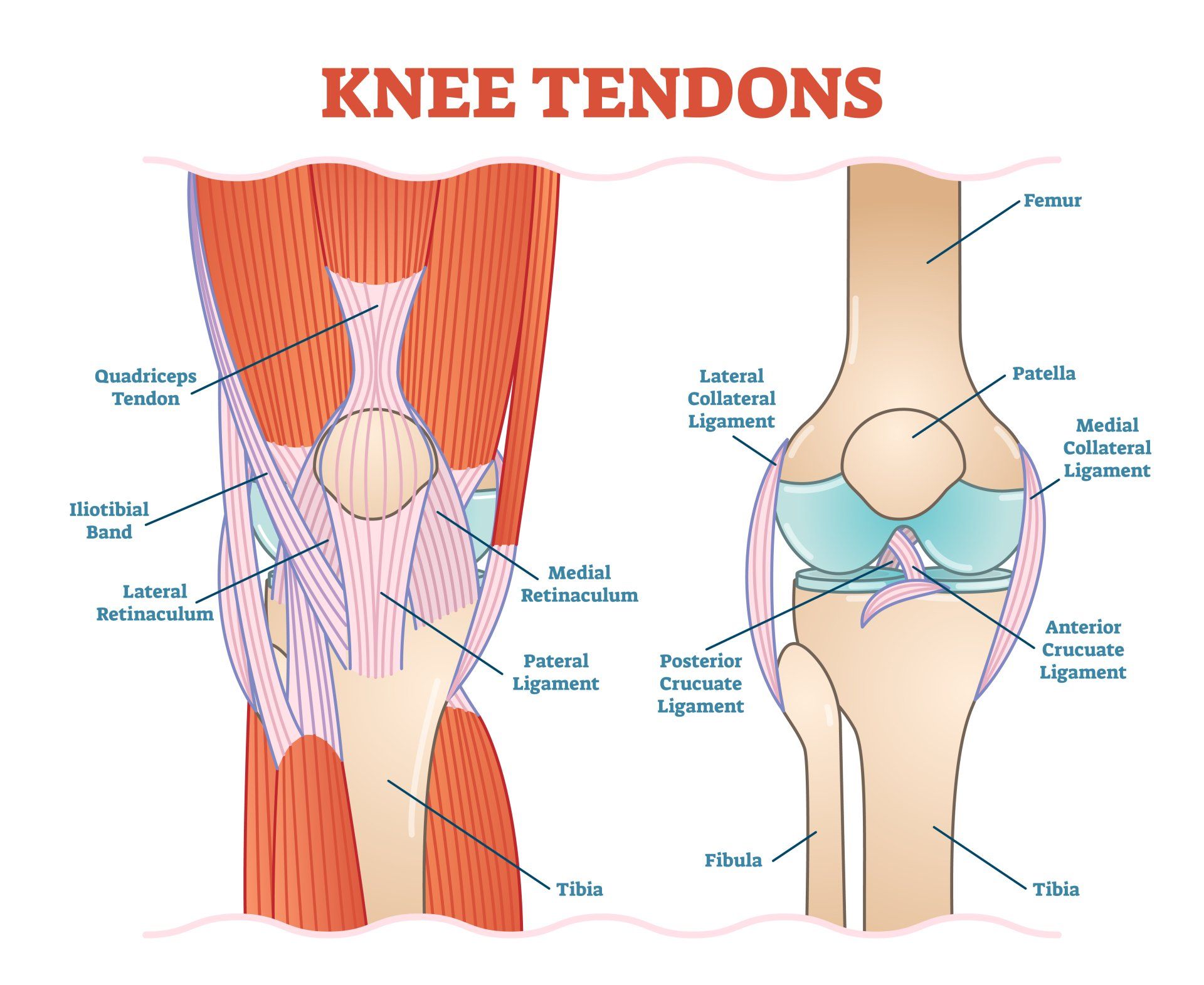 Knee Tendon Pain