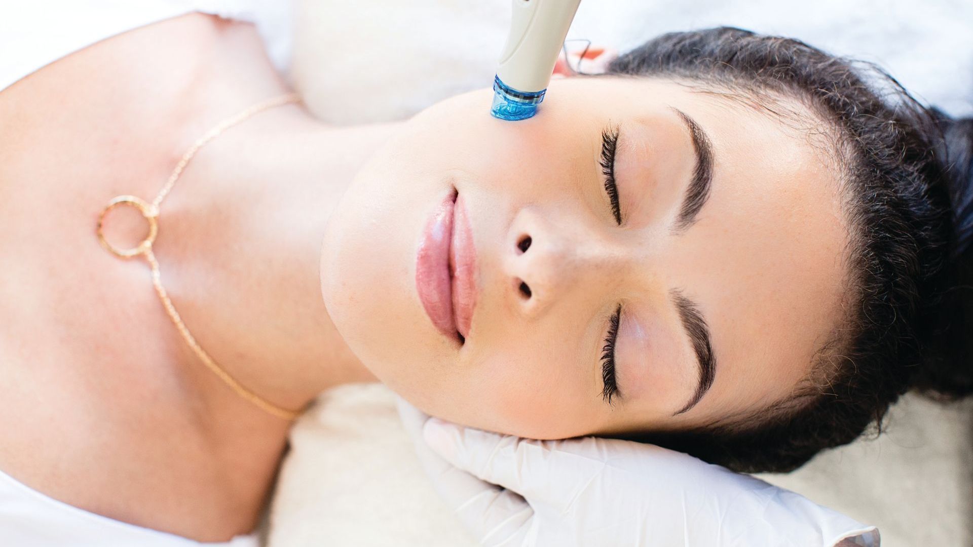 Eine Person, die sich einer professionellen Gesichtsbehandlung mit einem handgeführten Sauggerät an der Wange unterzieht.