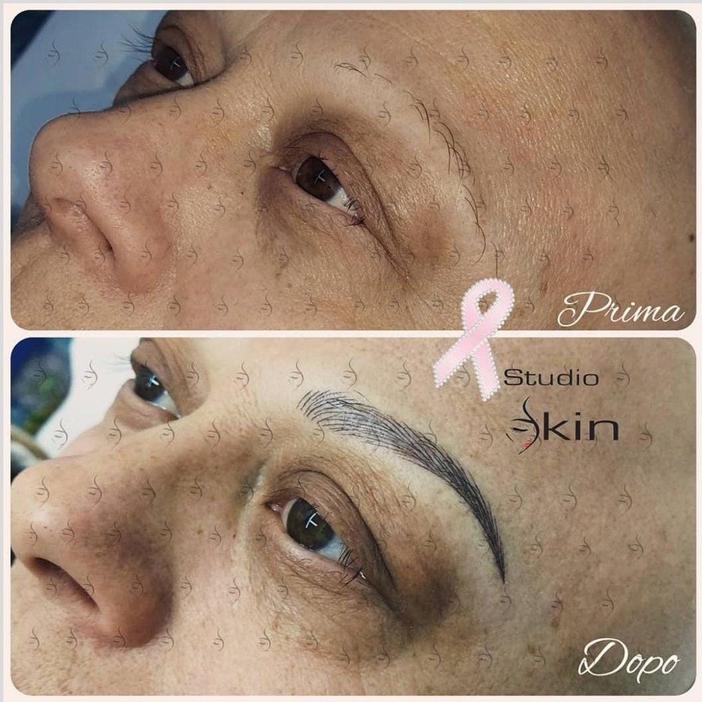 Estetica oncologica prima e dopo