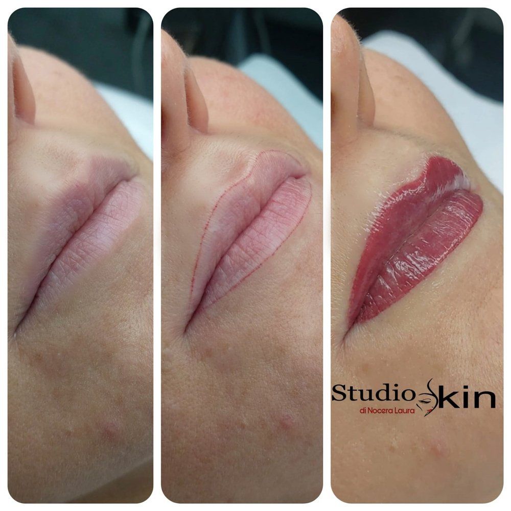Dermopigmentazione labbra