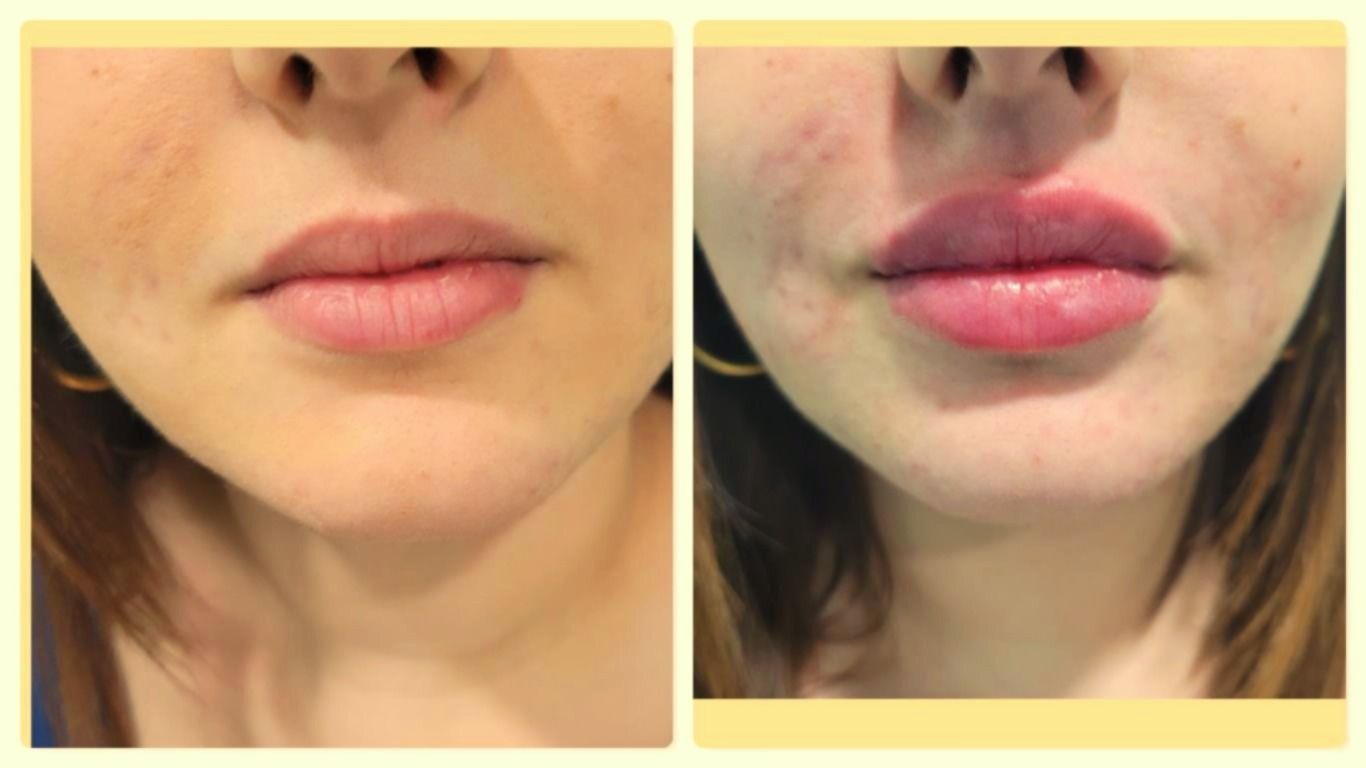 notevole riduzione delle rughe del viso