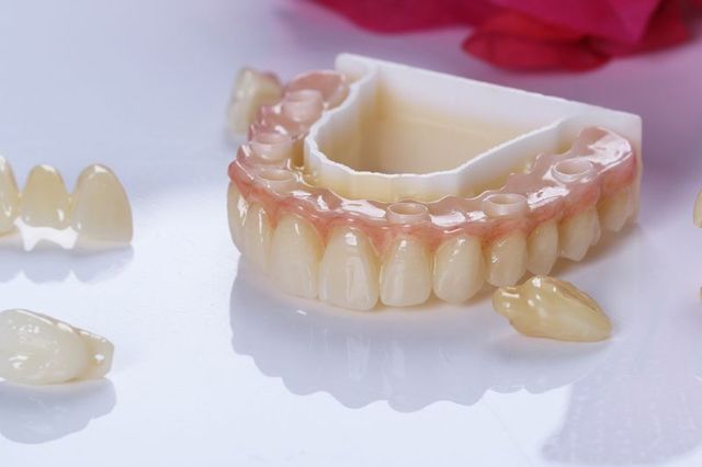 Z Crown Zirconia Crowns & Bridges | Bayshore Dental Studio