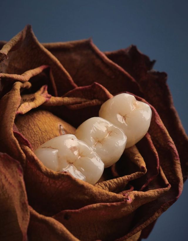 Z Crown Zirconia Crowns & Bridges | Bayshore Dental Studio