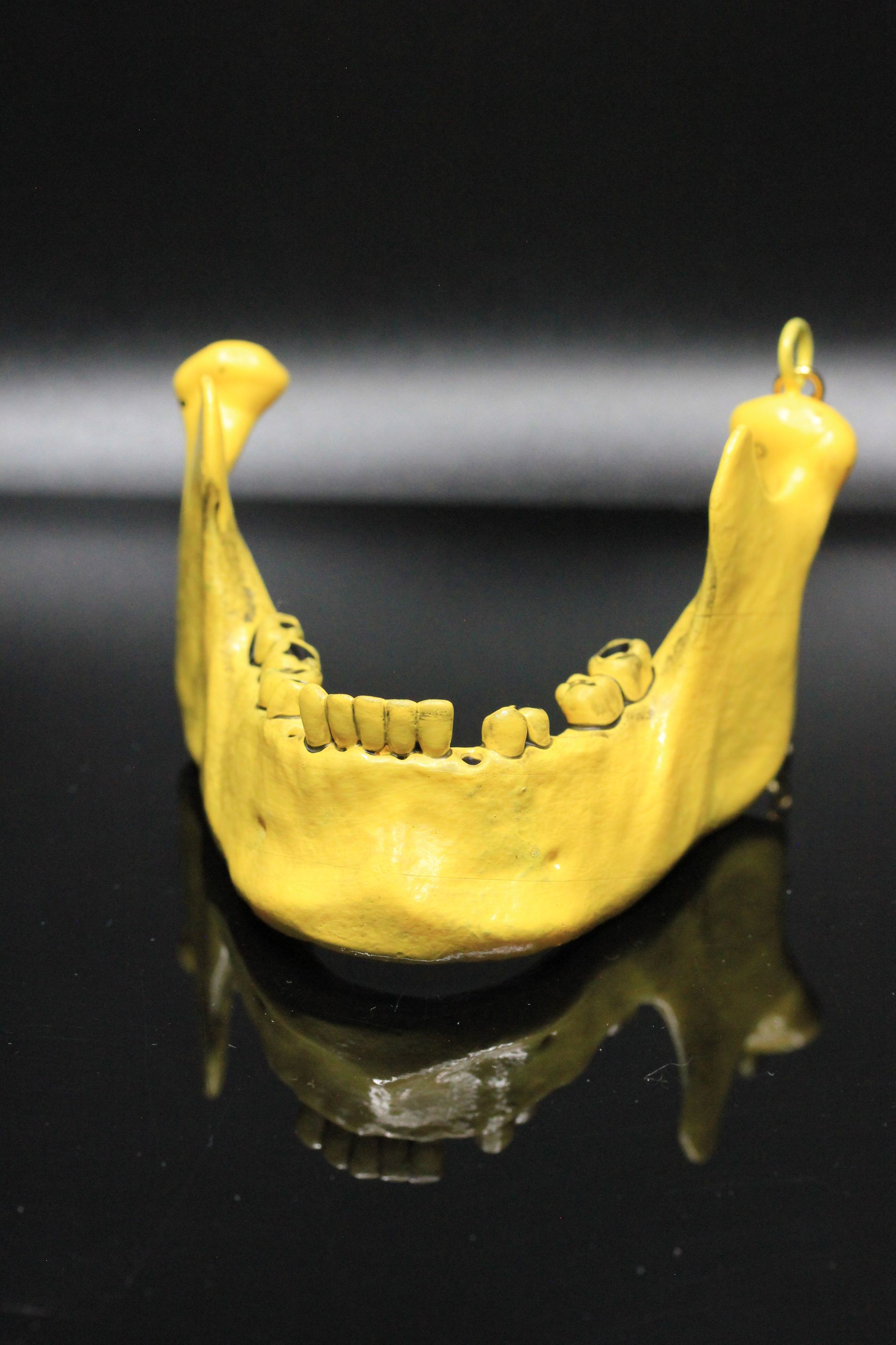 Child JawBone: Yellow