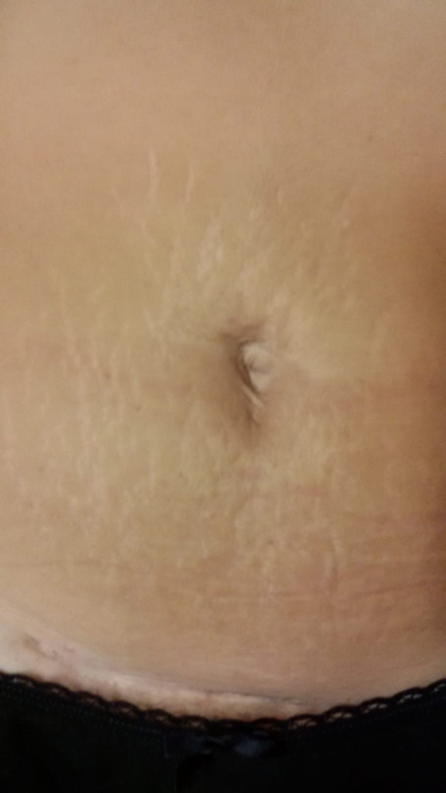 Prima del trattamento